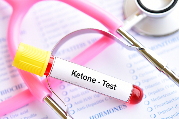 Keto OS NAT Before and After: The Best Fat-Burning Boost? 5 Blood sample tube for ketone test